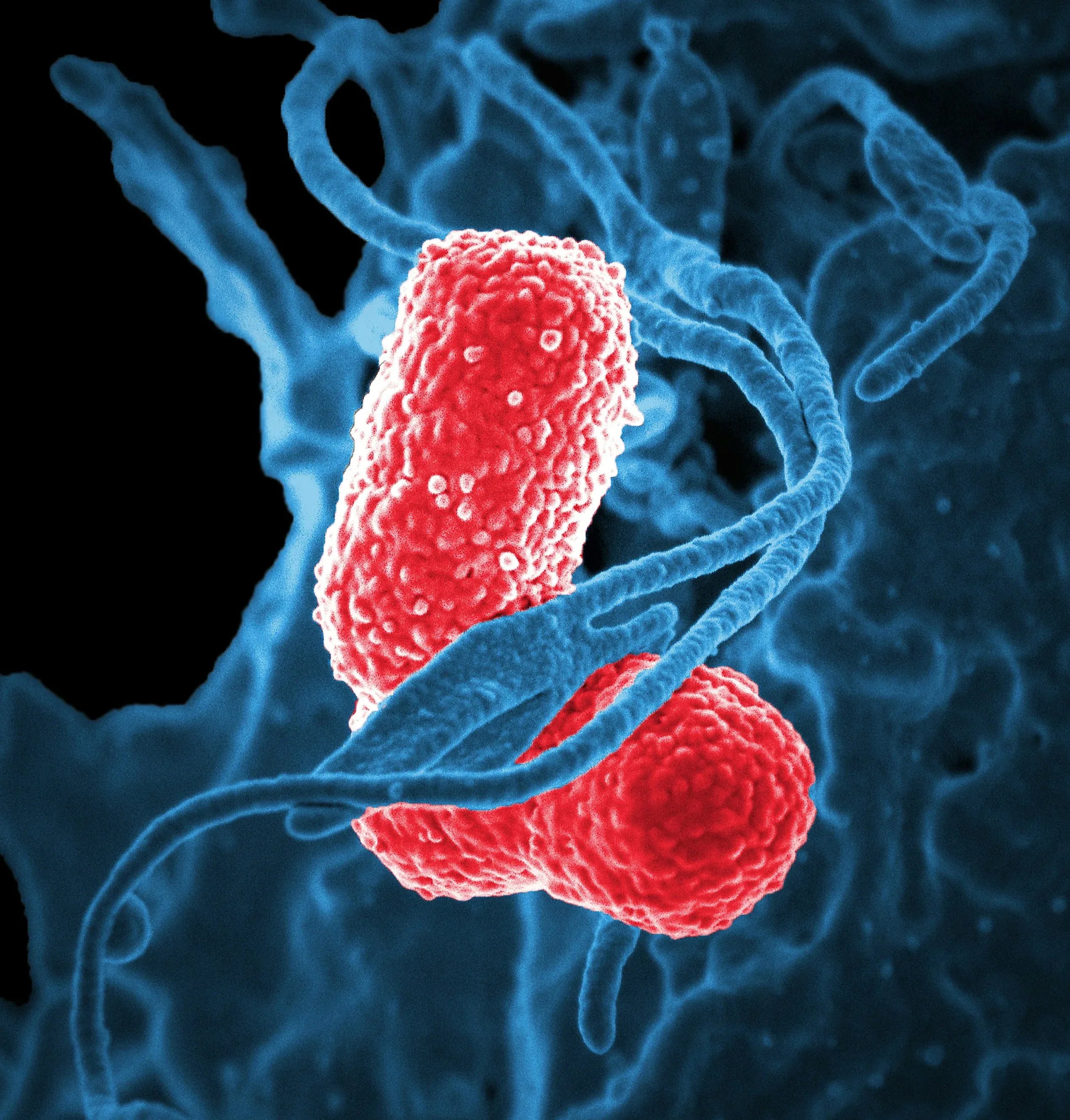 Dairy and Your Gut Microbiome: What a 2025 Study Found